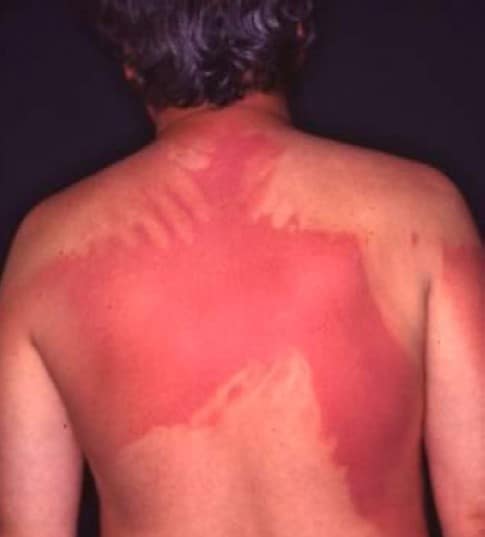 Do Sunscreens work? Of course they do … 7 EURO COSMETICS Magazine • Do Sunscreens work? Of course they do … • Uli Osterwalder • Uli Osterwalder