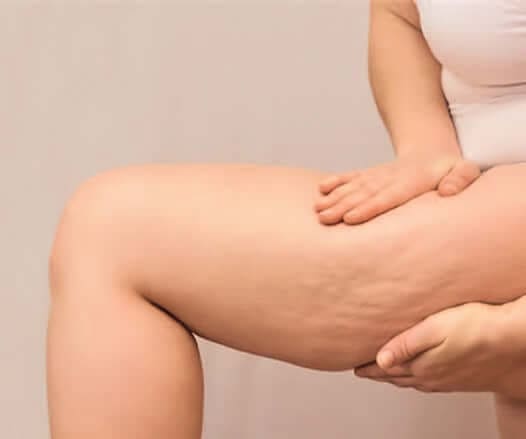 How to in vivo Objectivate Slimming Claims? 5 EURO COSMETICS Magazine • How to in vivo Objectivate Slimming Claims? • Anne Charpentier, Skinobs • Anne Charpentier, Skinobs