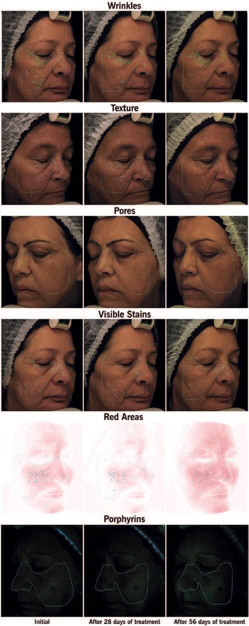 Plant-derived Peptides and Biotechnology 19 EURO COSMETICS Magazine • Plant-derived Peptides and Biotechnology • Ò. Expósito and M. Buchholz • Ò. Expósito and M. Buchholz