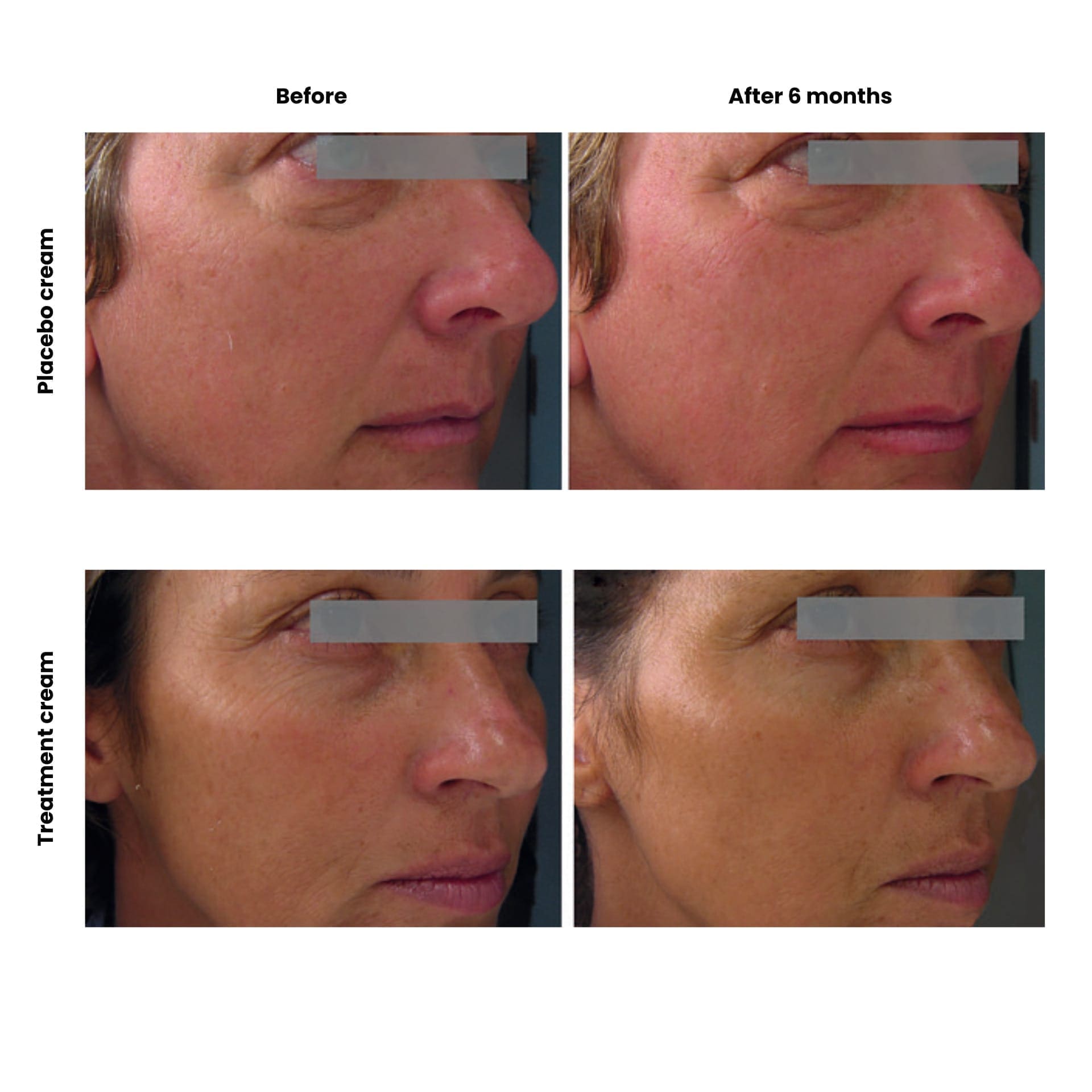 How to stop the skin from ageing faster than it should 5 EURO COSMETICS Magazine • How to stop the skin from ageing faster than it should • Dr. Larissa Legewie • Dr. Larissa Legewie