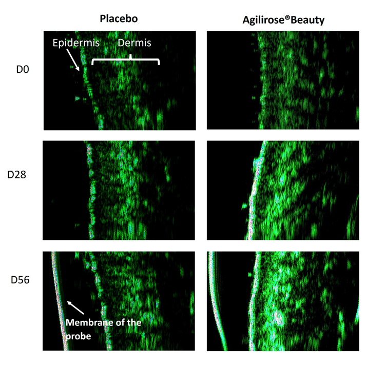 Redensify, Rehydrate, Rejuvenate: Clinical Insights on AGILIROSE® BEAUTY 10 EURO COSMETICS Magazine • Redensify, Rehydrate, Rejuvenate: Clinical Insights on AGILIROSE® BEAUTY • Cynthia G. Suárez Rizzo • Cynthia G. Suárez Rizzo